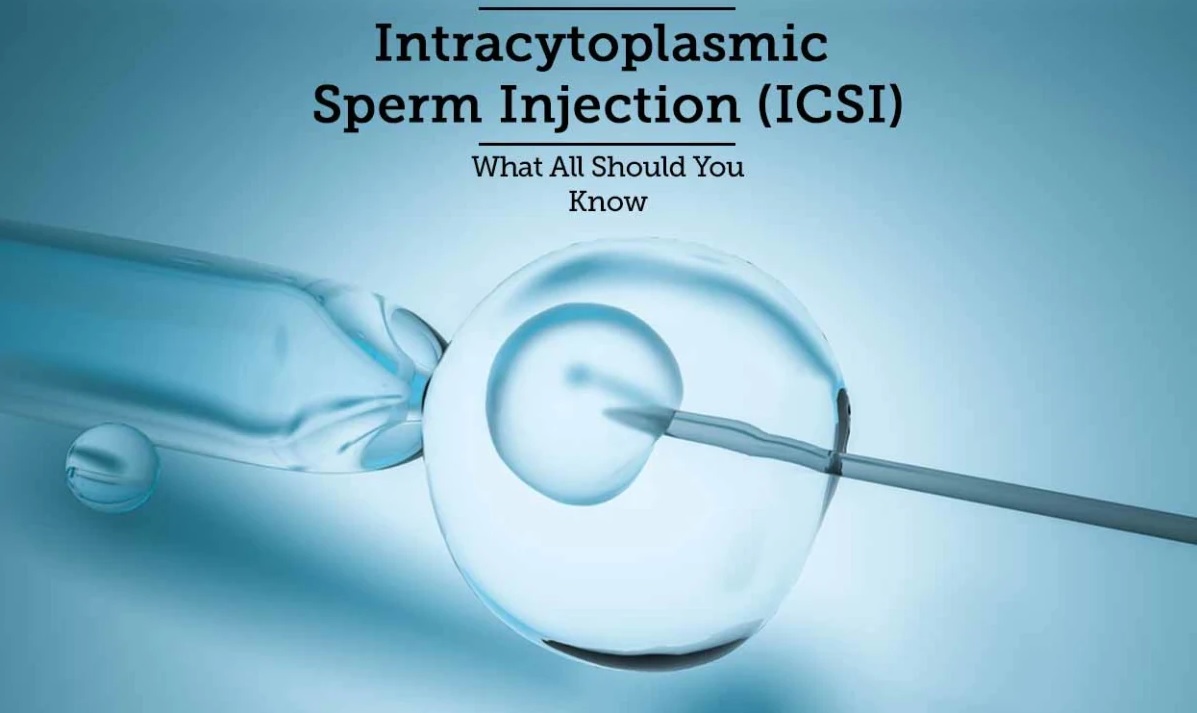 intracytoplasmic sperm injection(icsi) cnh1